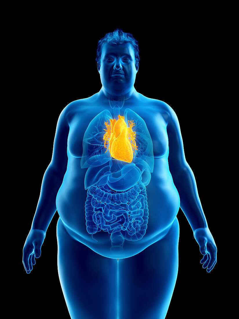 Illustration of an obese man's heart