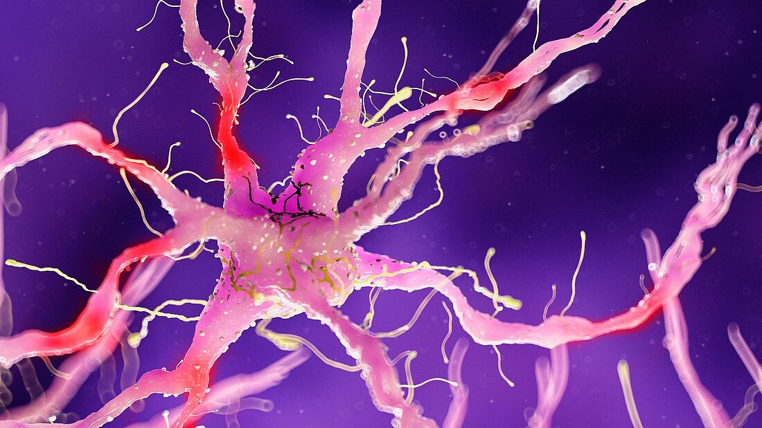 Illustration of a damaged nerve cell