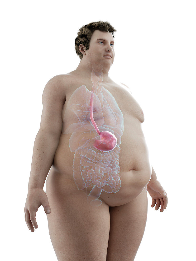 Illustration of an obese man's stomach