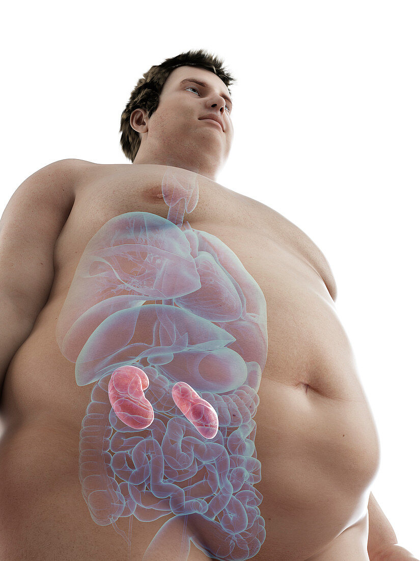 Illustration of an obese man's kidneys