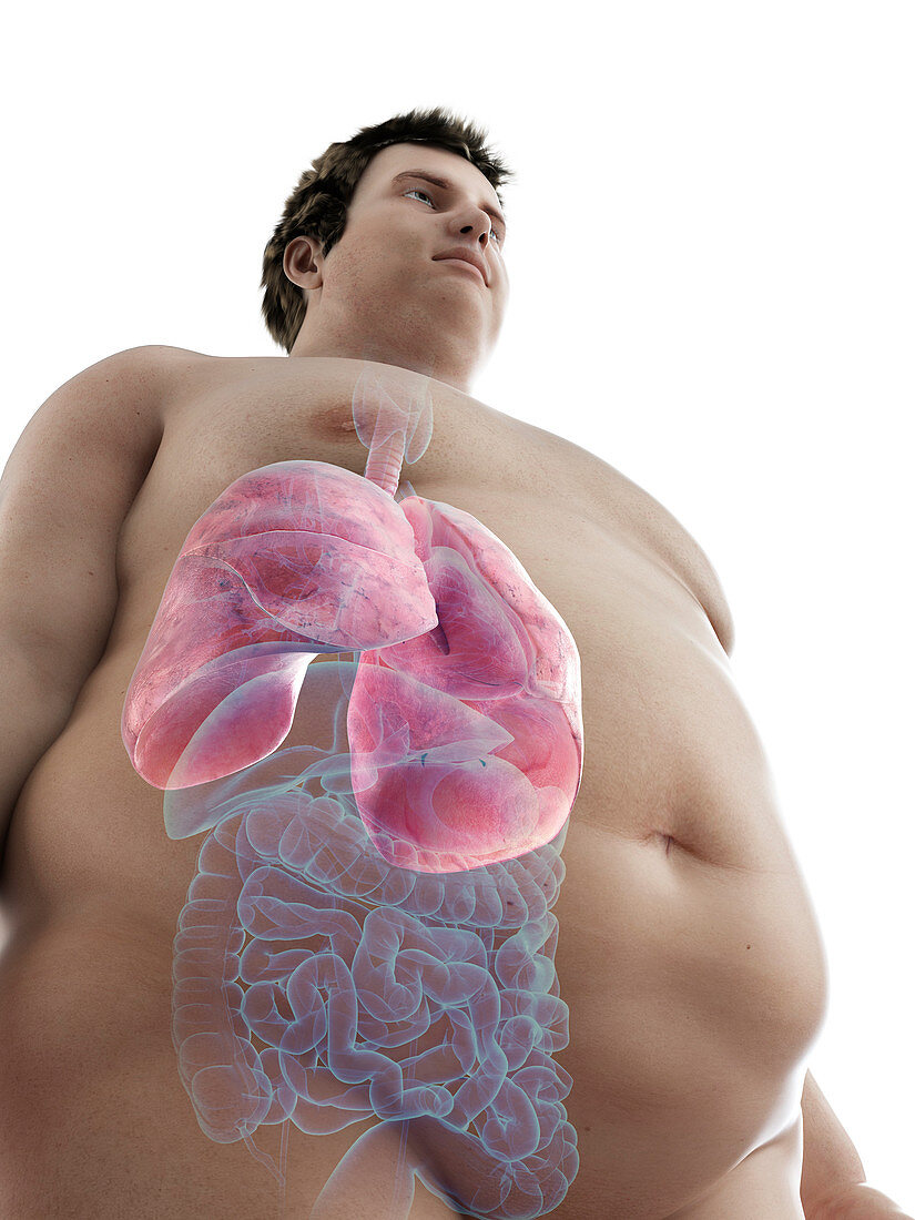 Illustration of an obese man's lungs