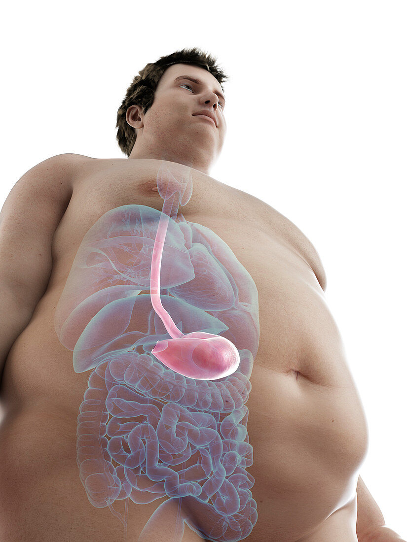 Illustration of an obese man's stomach