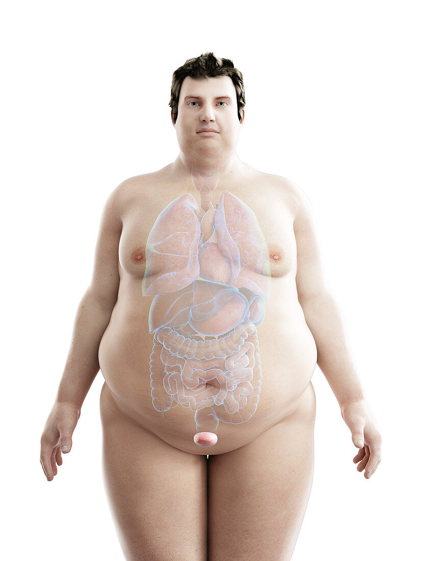 Illustration of an obese man's bladder