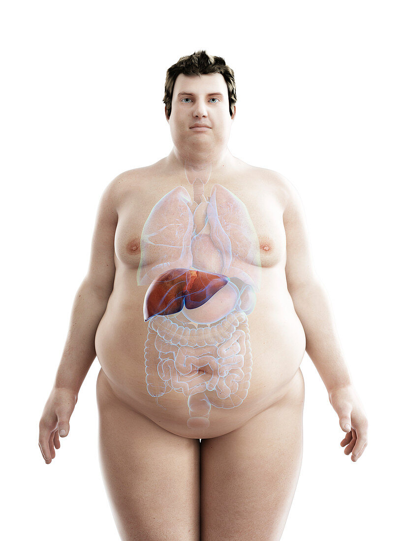 Illustration of an obese man's liver