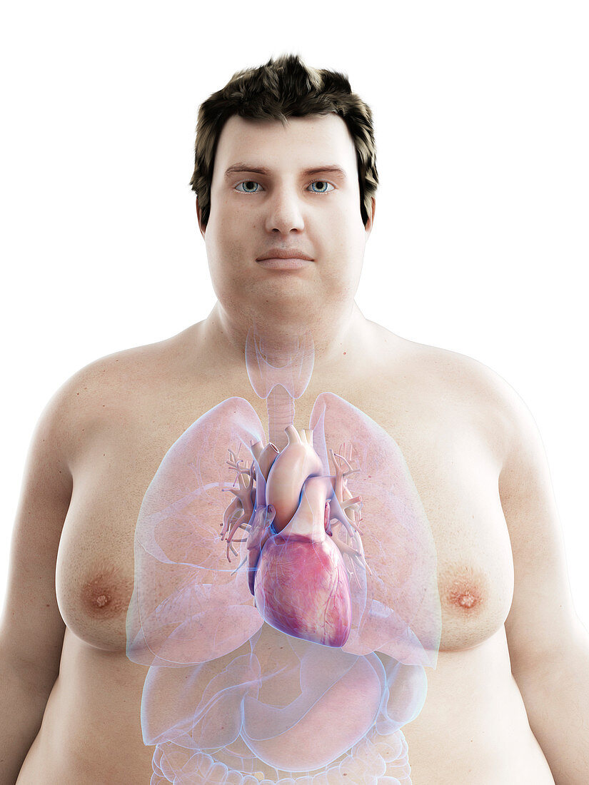 Illustration of an obese man's heart