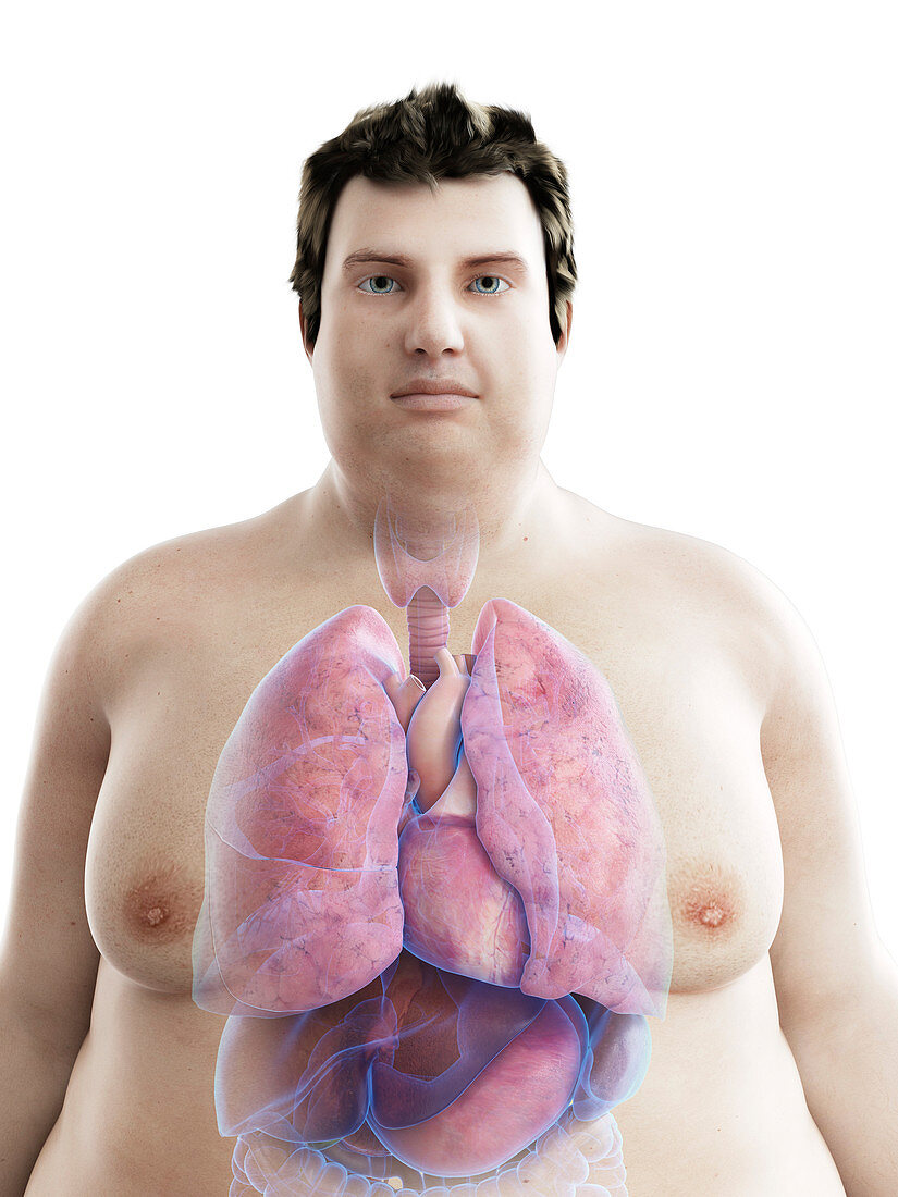 Illustration of an obese man's organs