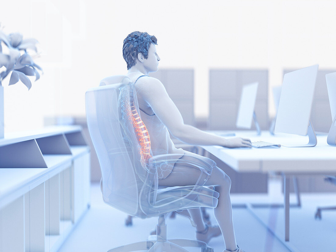 Illustration of an office worker with a painful back