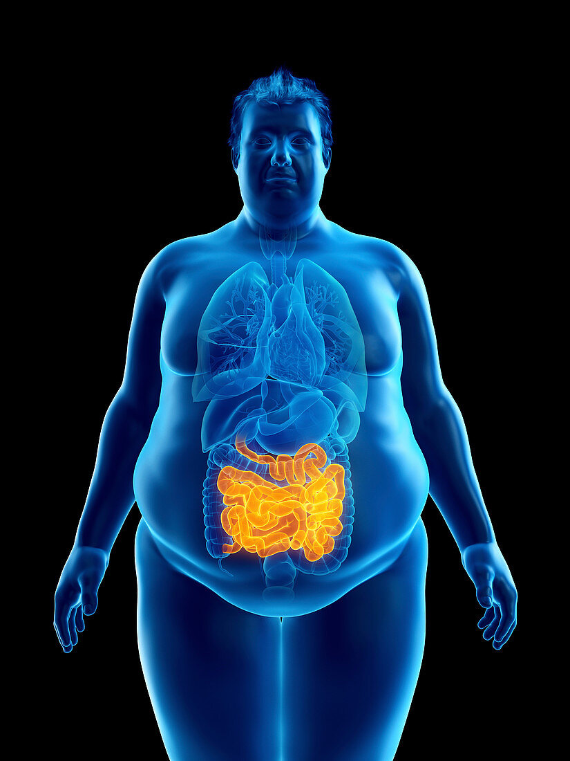 Illustration of an obese man's intestine