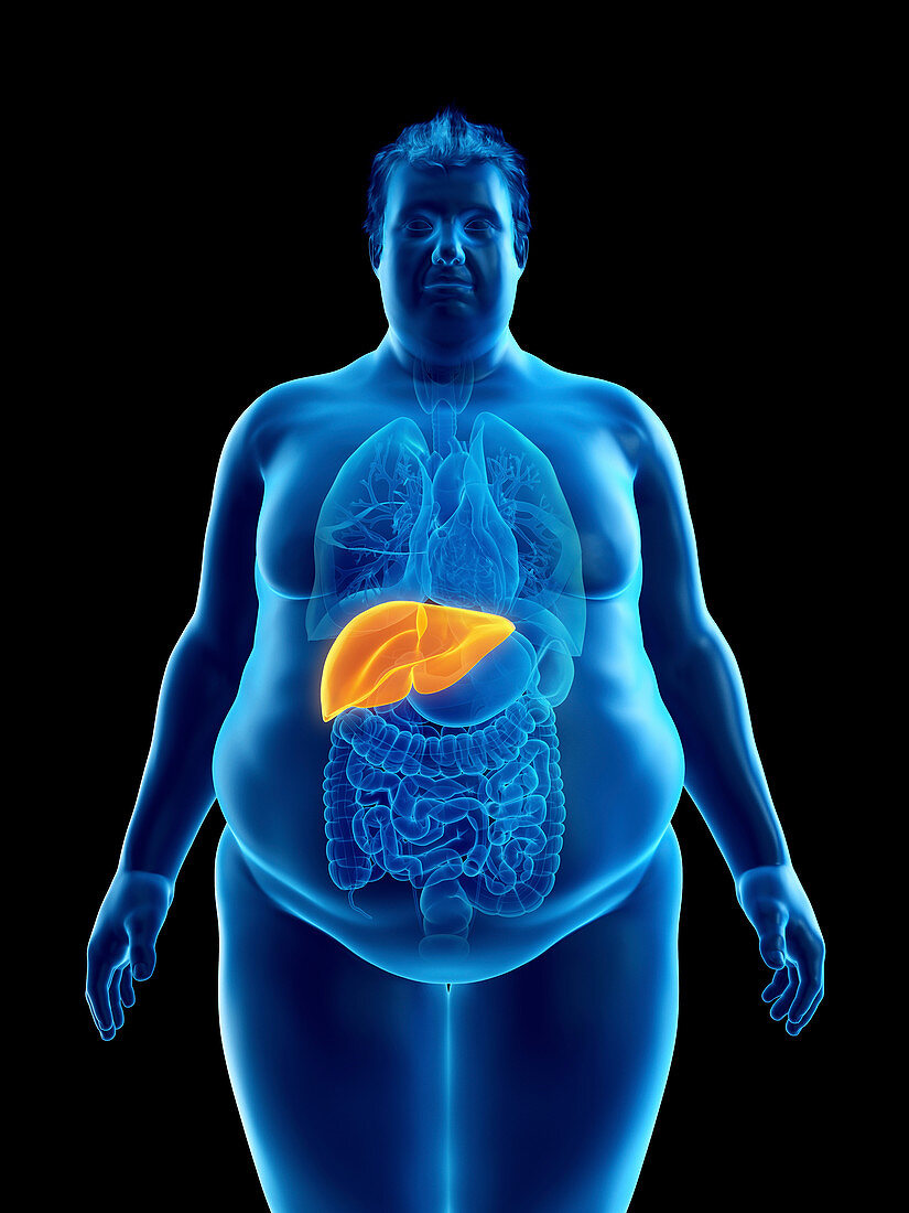 Illustration of an obese man's liver