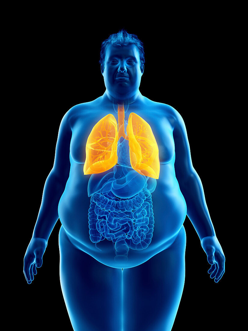 Illustration of an obese man's lungs