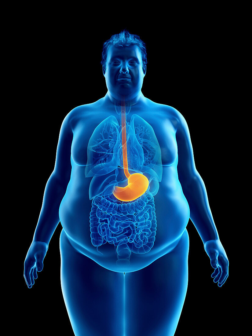 Illustration of an obese man's stomach