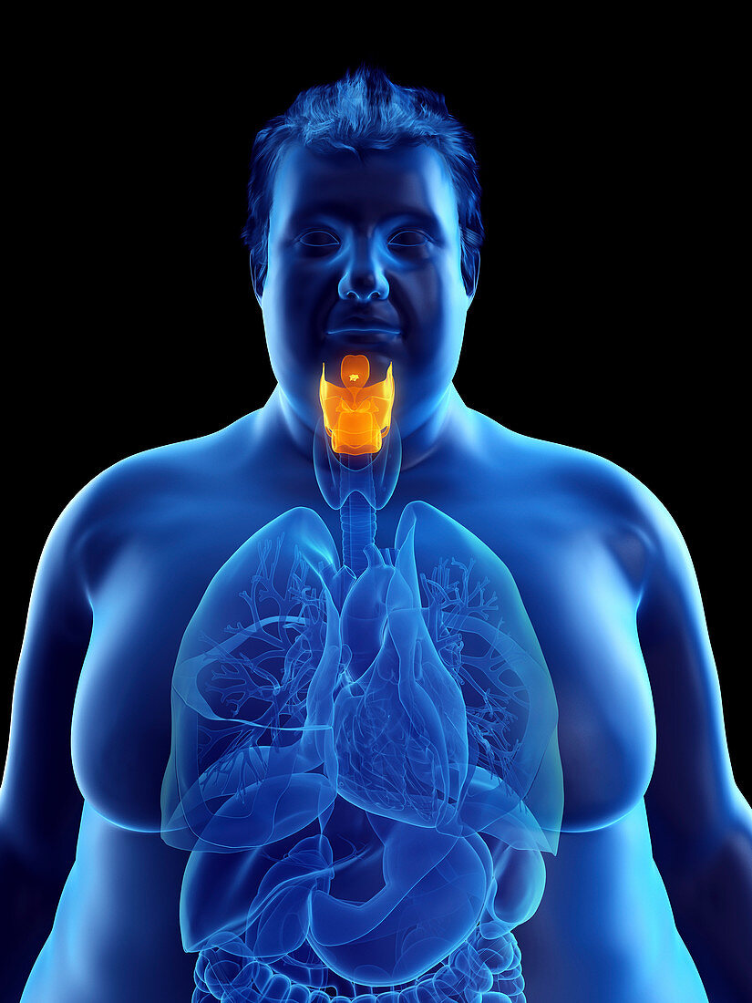 Illustration of an obese man's larynx