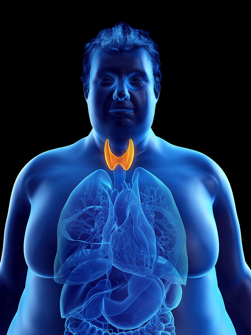 Illustration of an obese man's thyroid gland