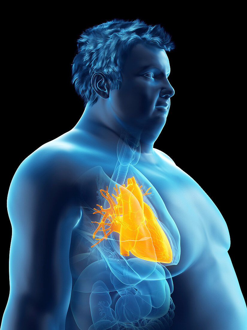 Illustration of an obese man's heart