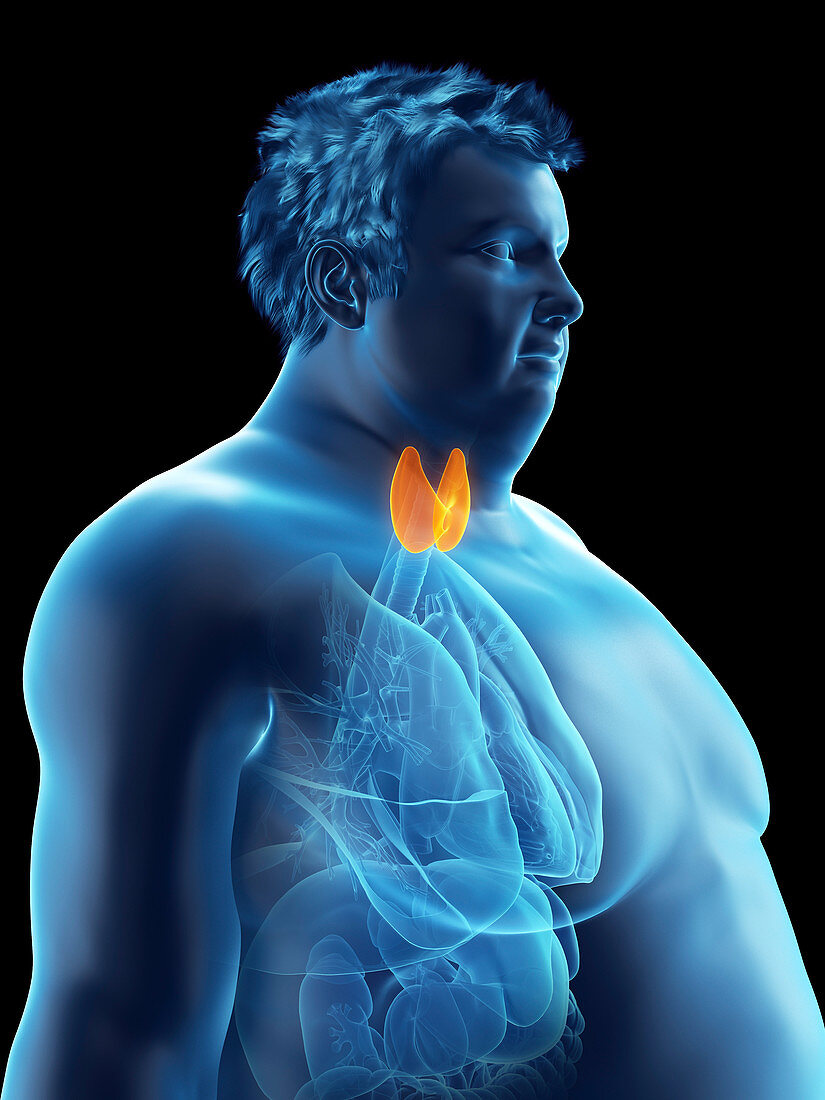 Illustration of an obese man's thyroid gland