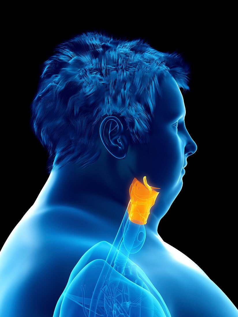 Illustration of an obese man's larynx