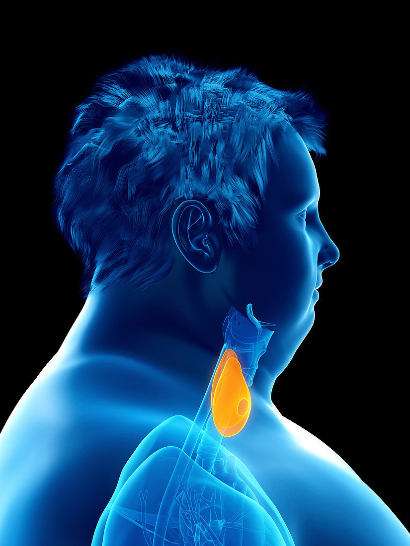 Illustration of an obese man's thyroid gland