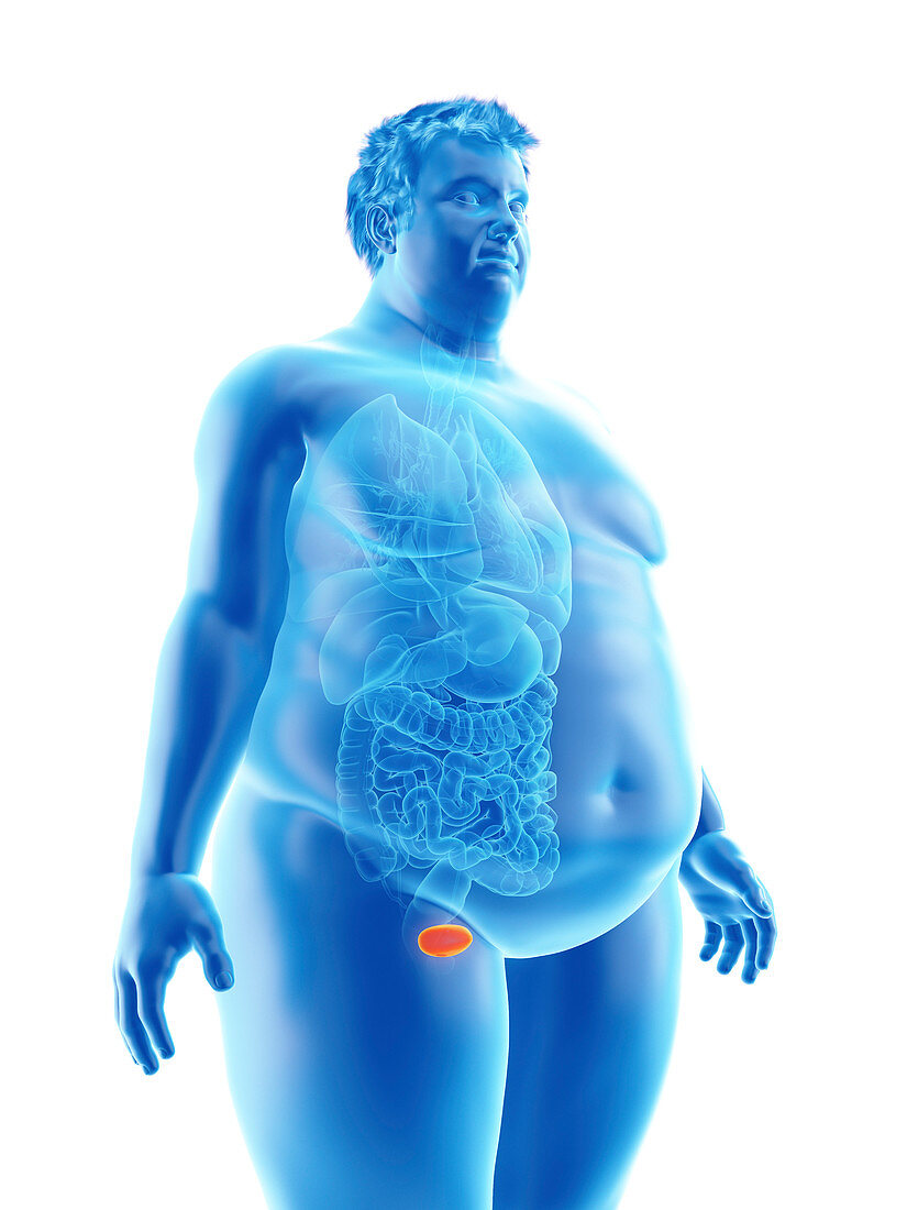 Illustration of an obese man's bladder