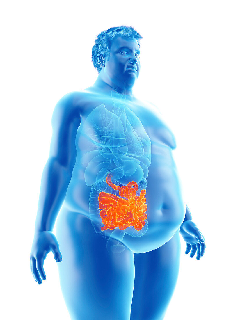 Illustration of an obese man's intestine