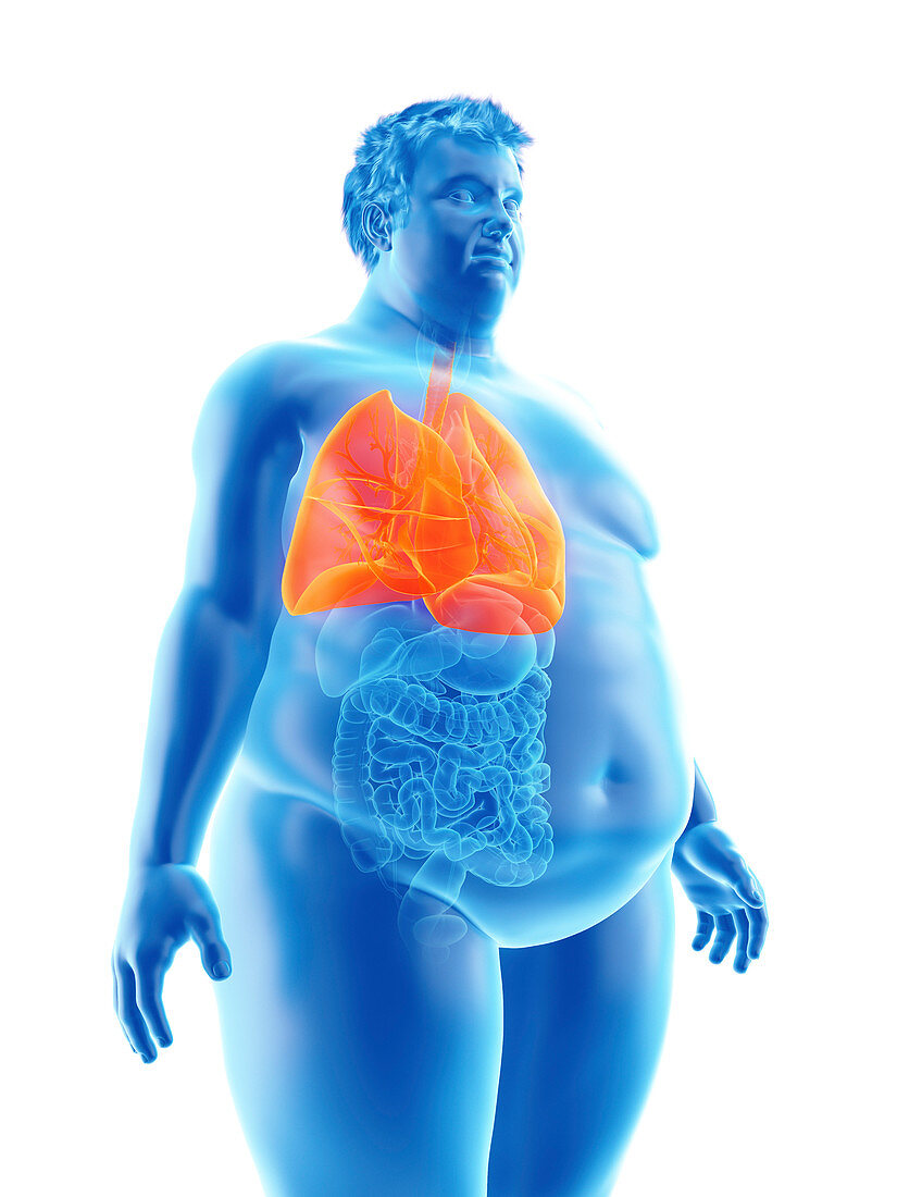 Illustration of an obese man's lungs