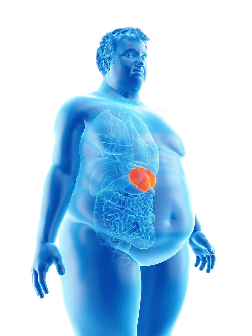 Illustration of an obese man's spleen