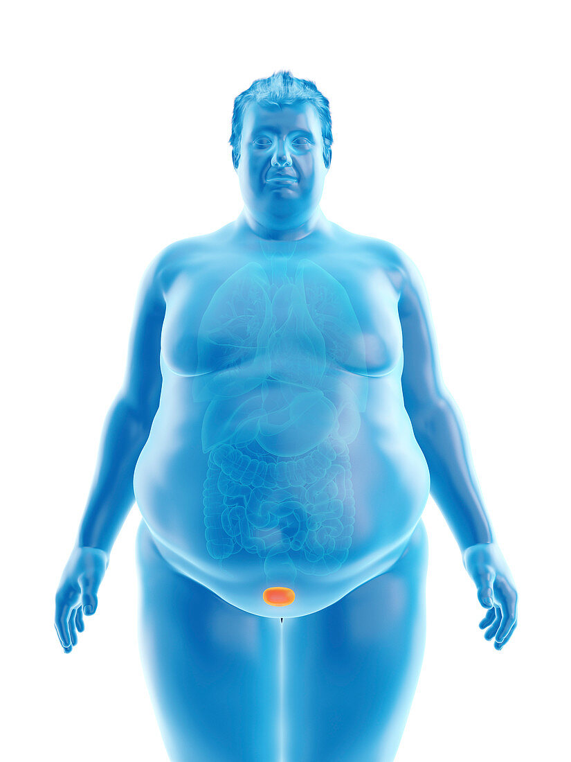 Illustration of an obese man's bladder