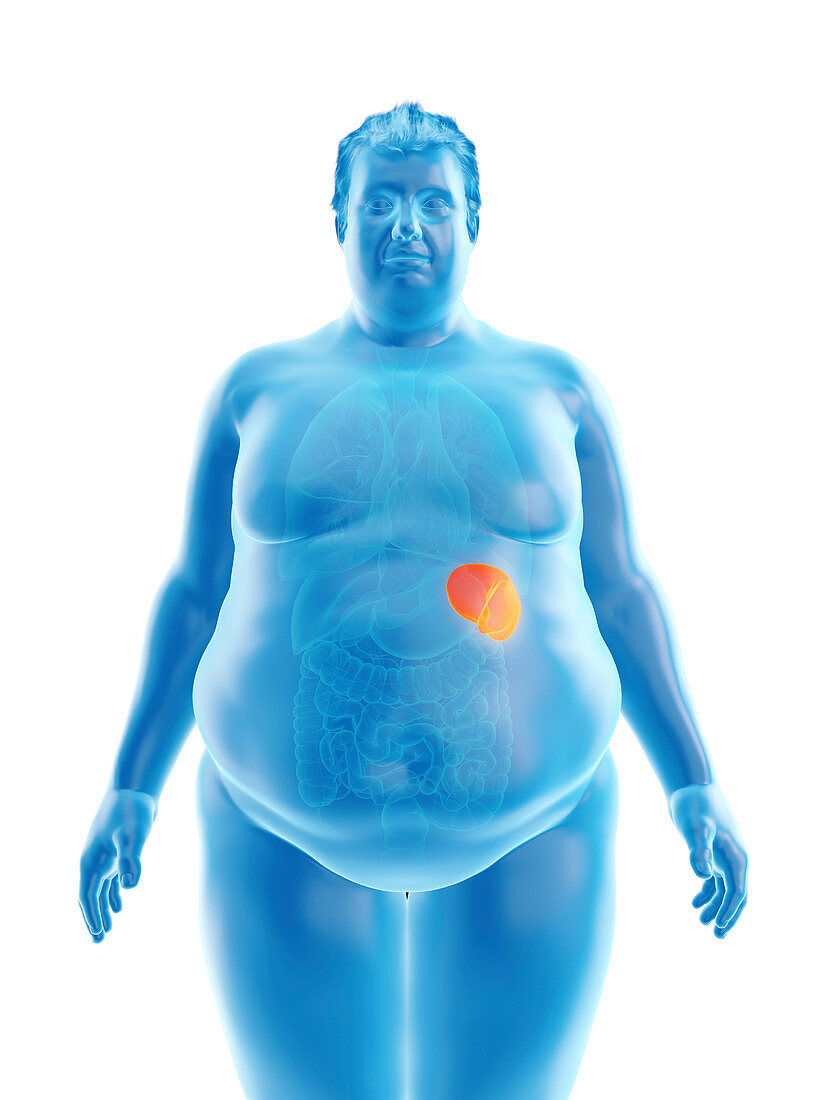 Illustration of an obese man's spleen