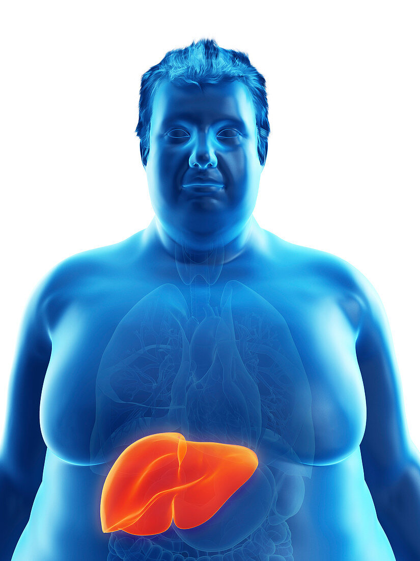 Illustration of an obese man's liver