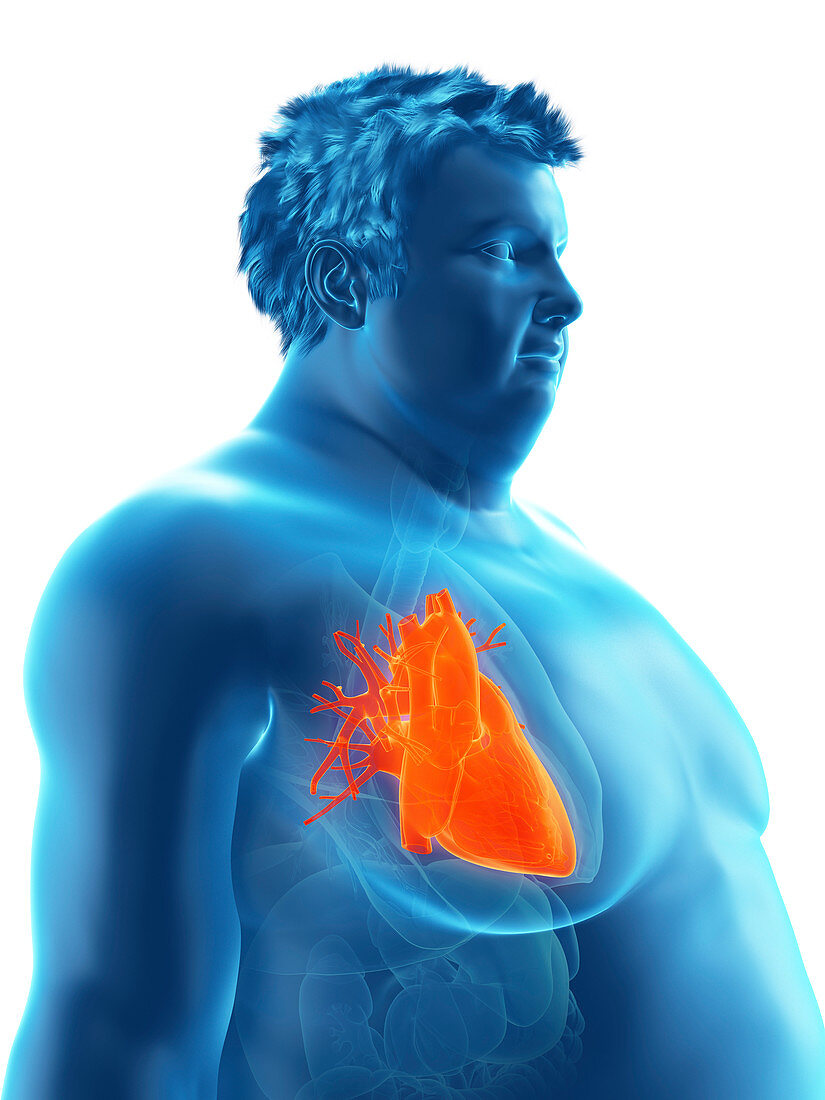Illustration of an obese man's heart