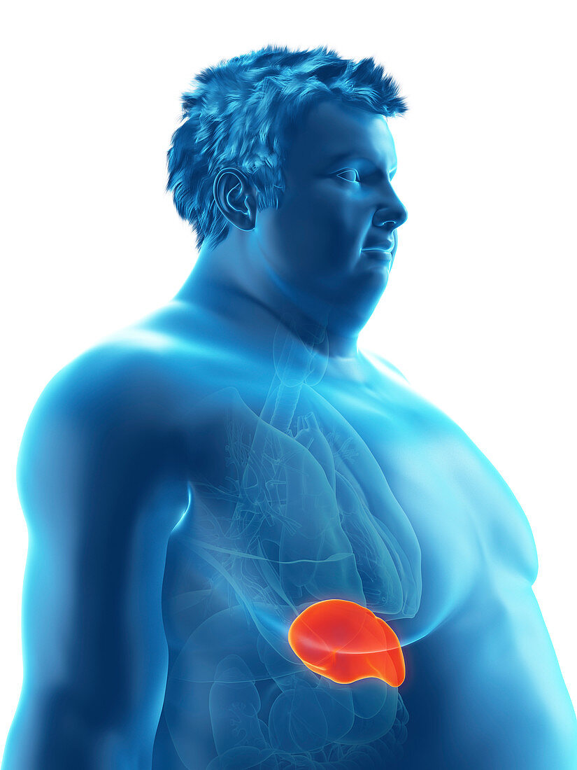 Illustration of an obese man's spleen