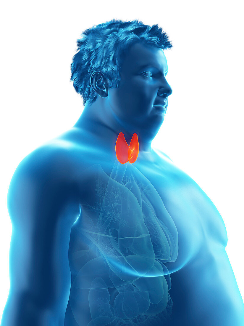 Illustration of an obese man's thyroid gland