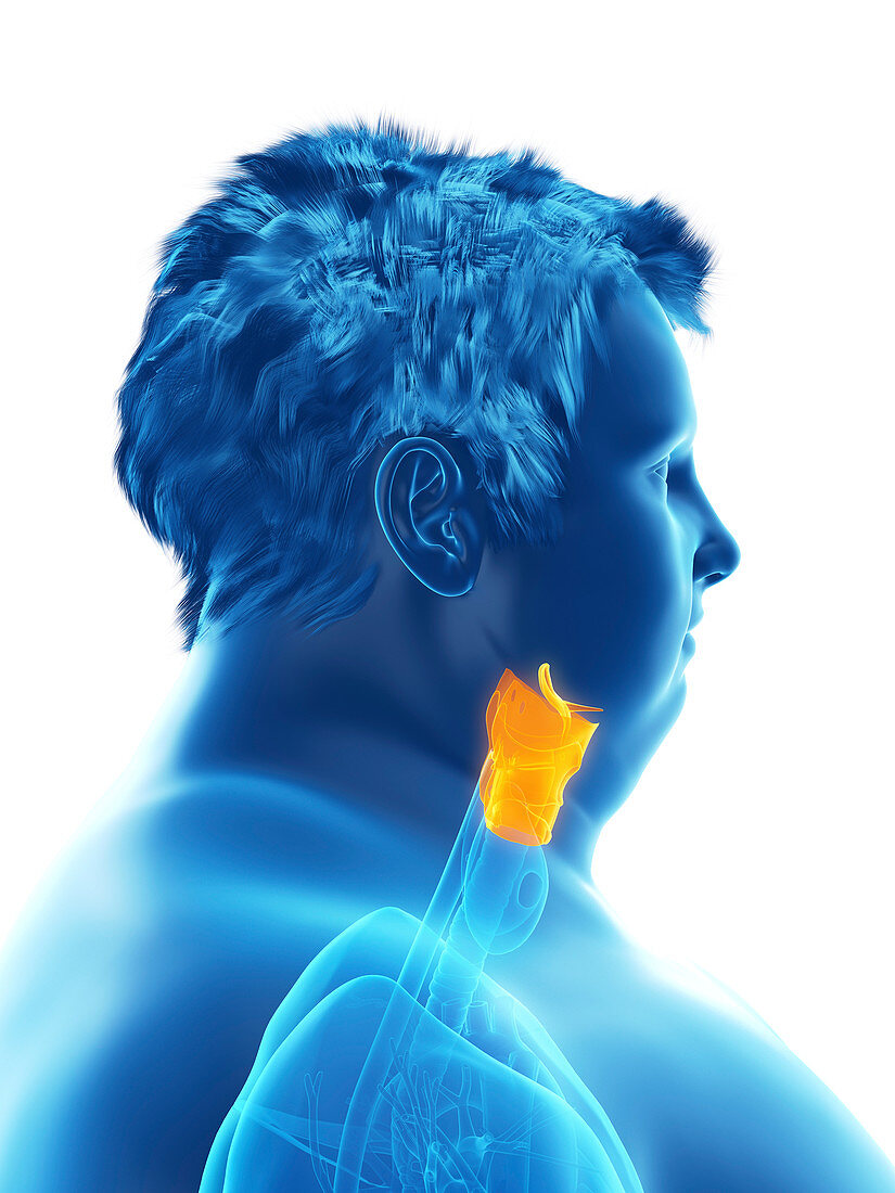 Illustration of an obese man's larynx