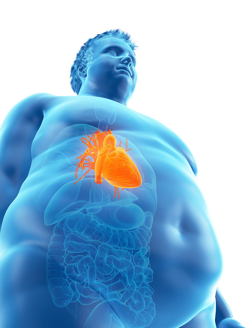 Illustration of an obese man's heart