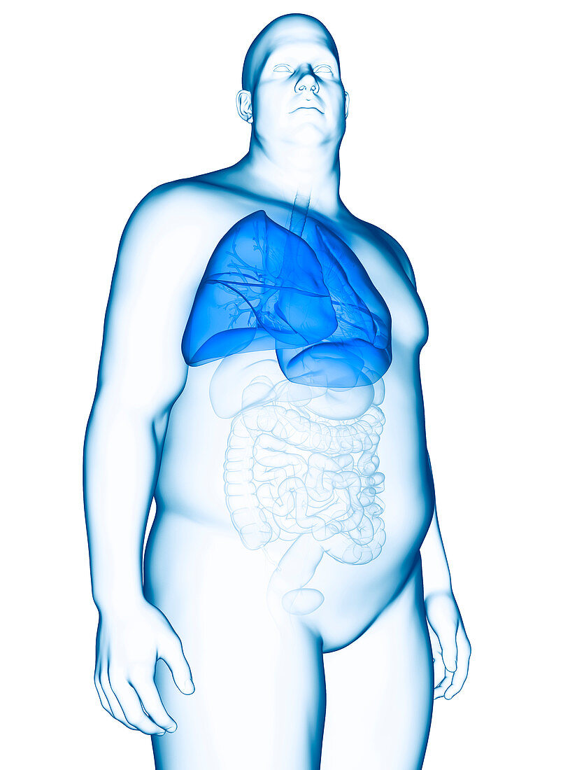 Illustration of an obese man's lung