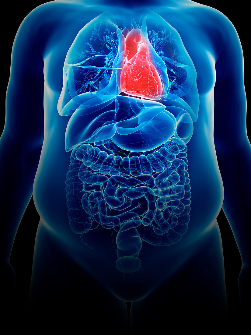 Illustration of an obese man's heart