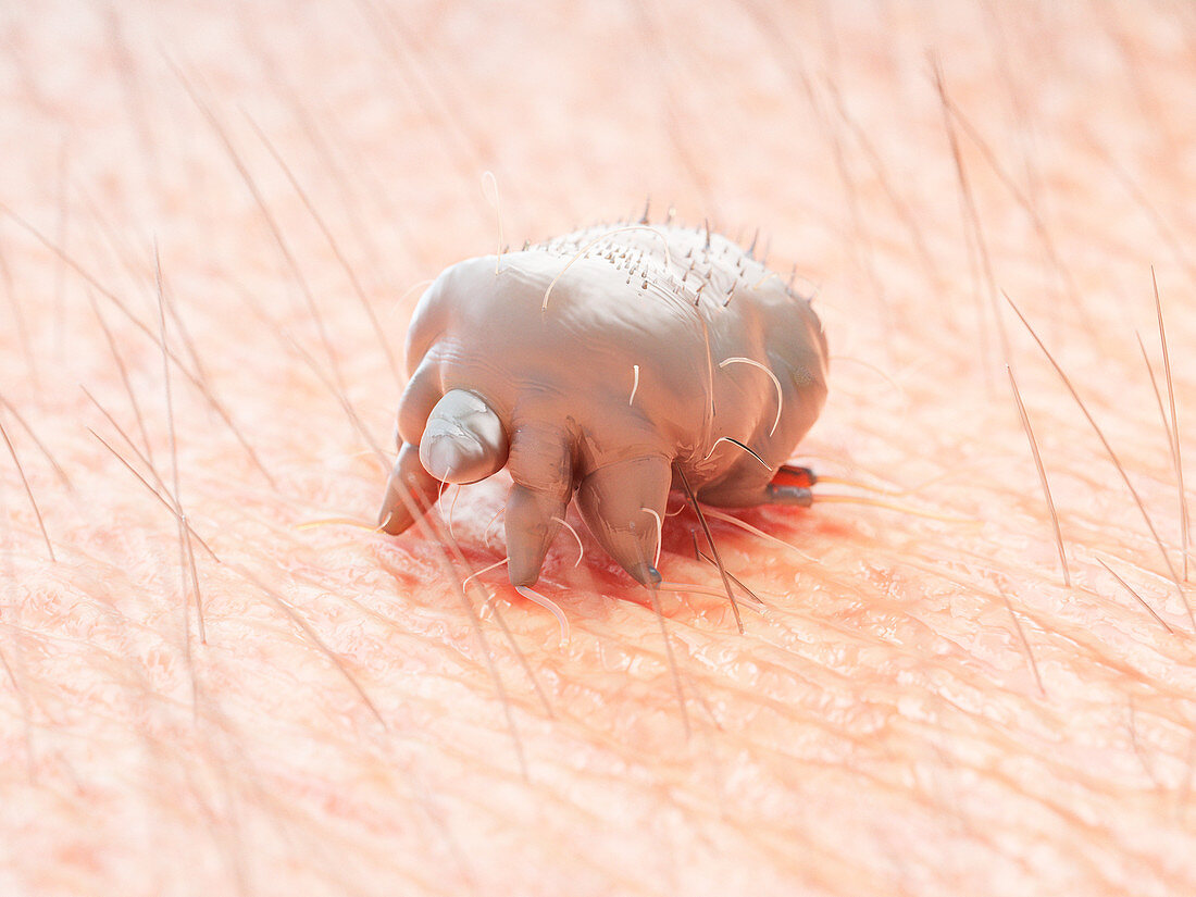 Illustration of a scabies mite on human skin