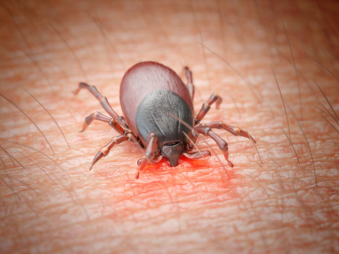Illustration of a tick biting human skin