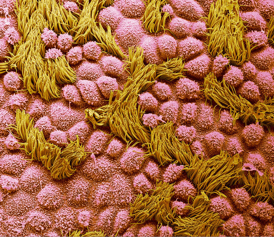 Fallopian tube, SEM