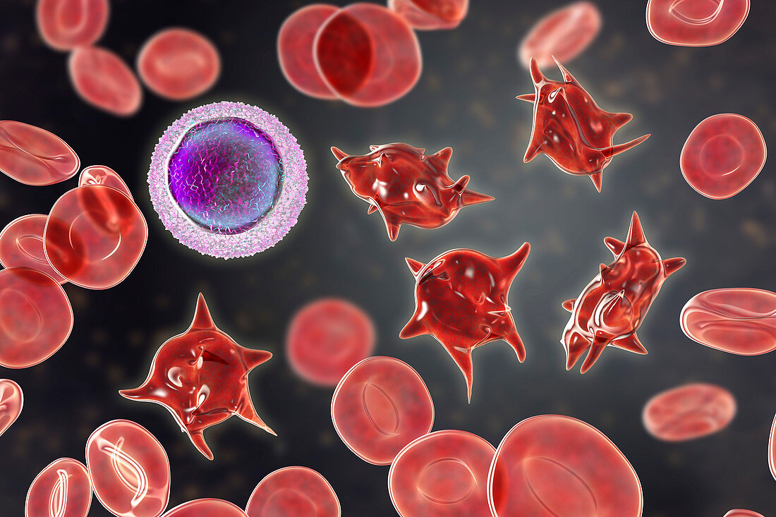 Acanthocyte abnormal red blood cells, illustration