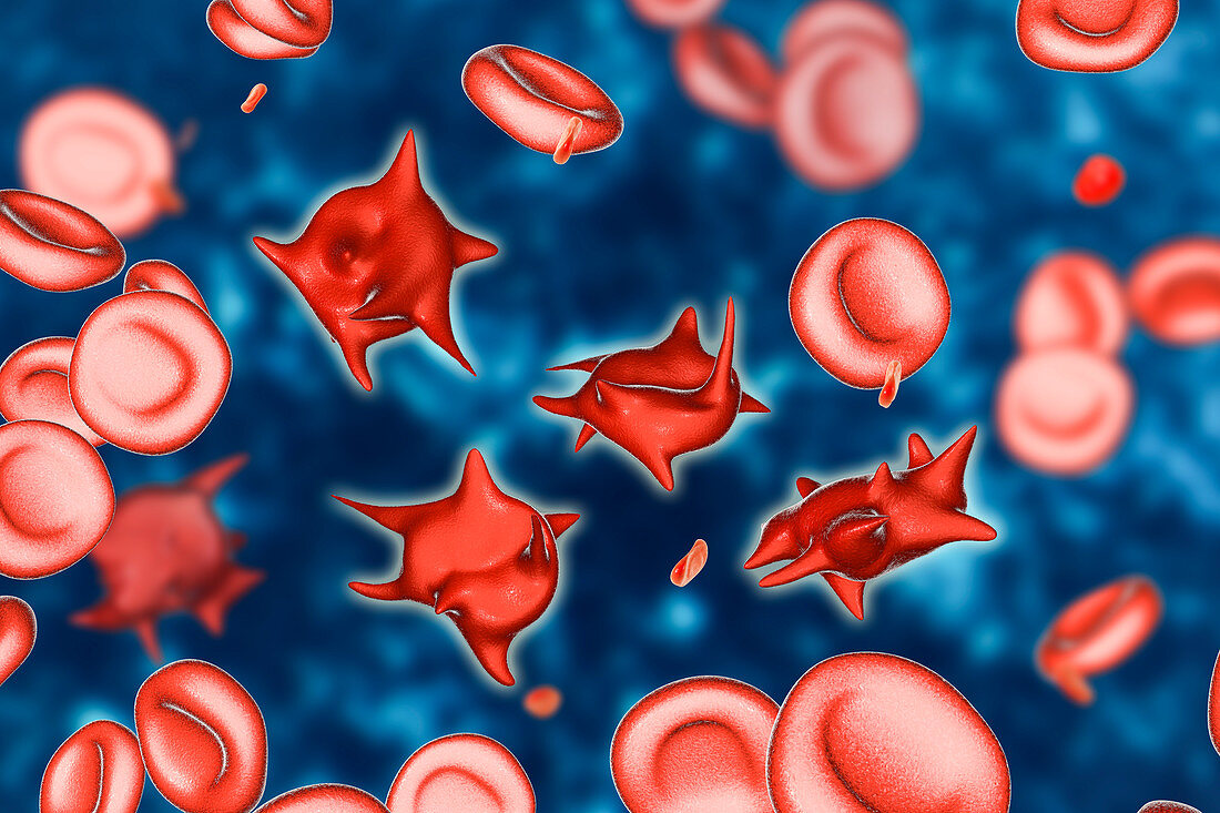 Acanthocyte abnormal red blood cells, illustration