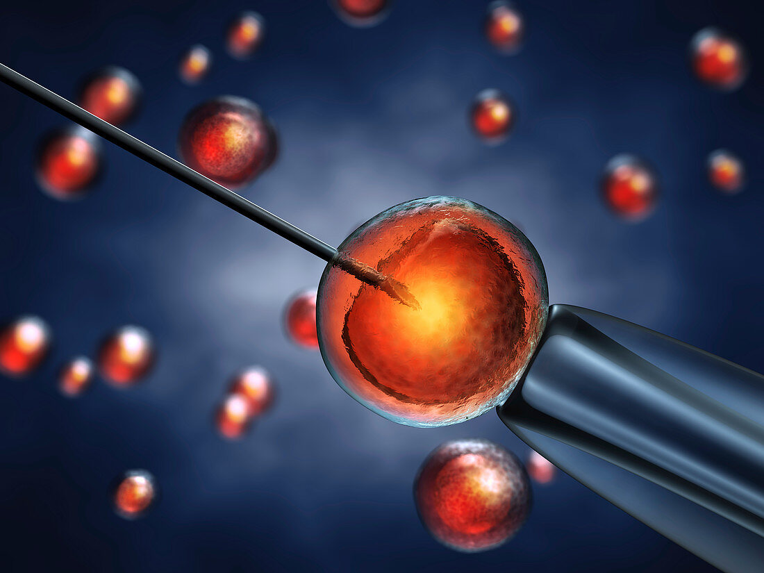 In vitro fertilization, illustration