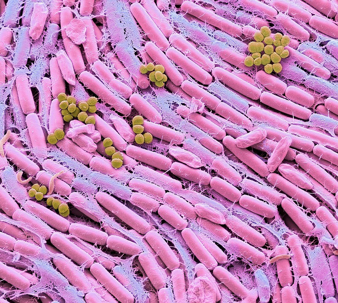 Breast milk bacteria, SEM