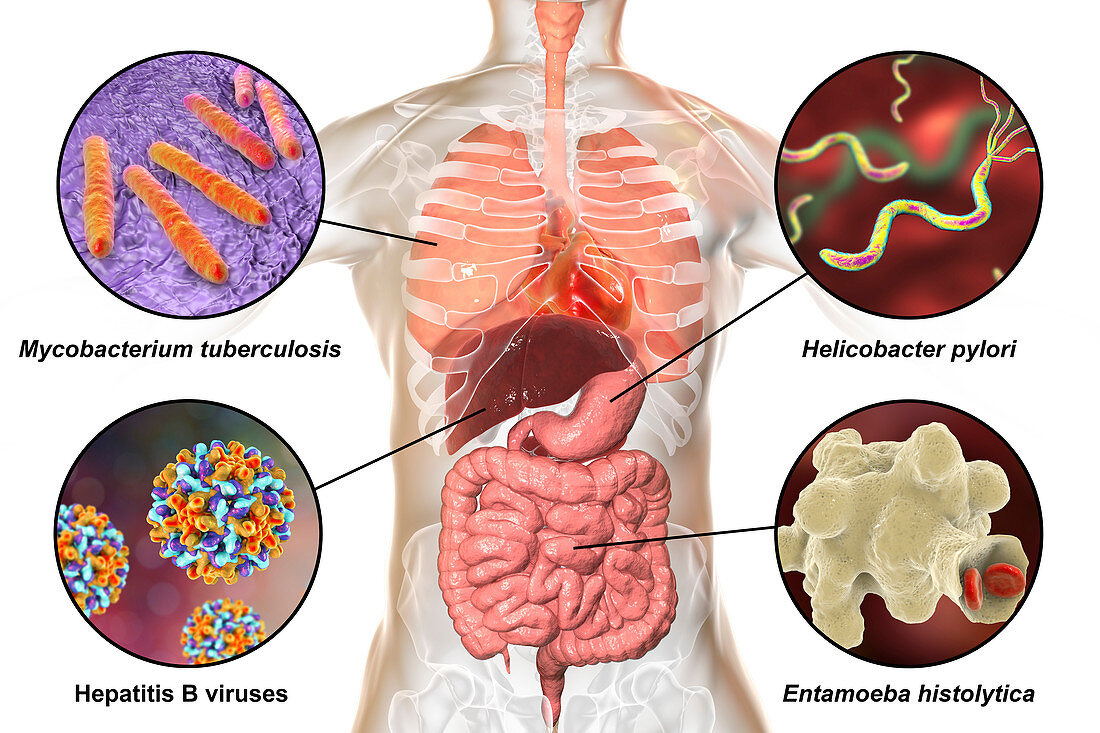 Bacteria that cause human infections, illustration