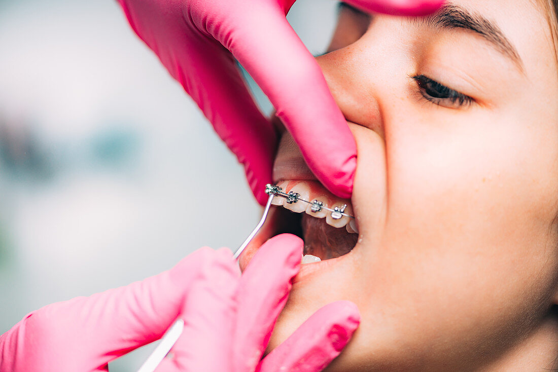 Orthodontist checking girl's braces