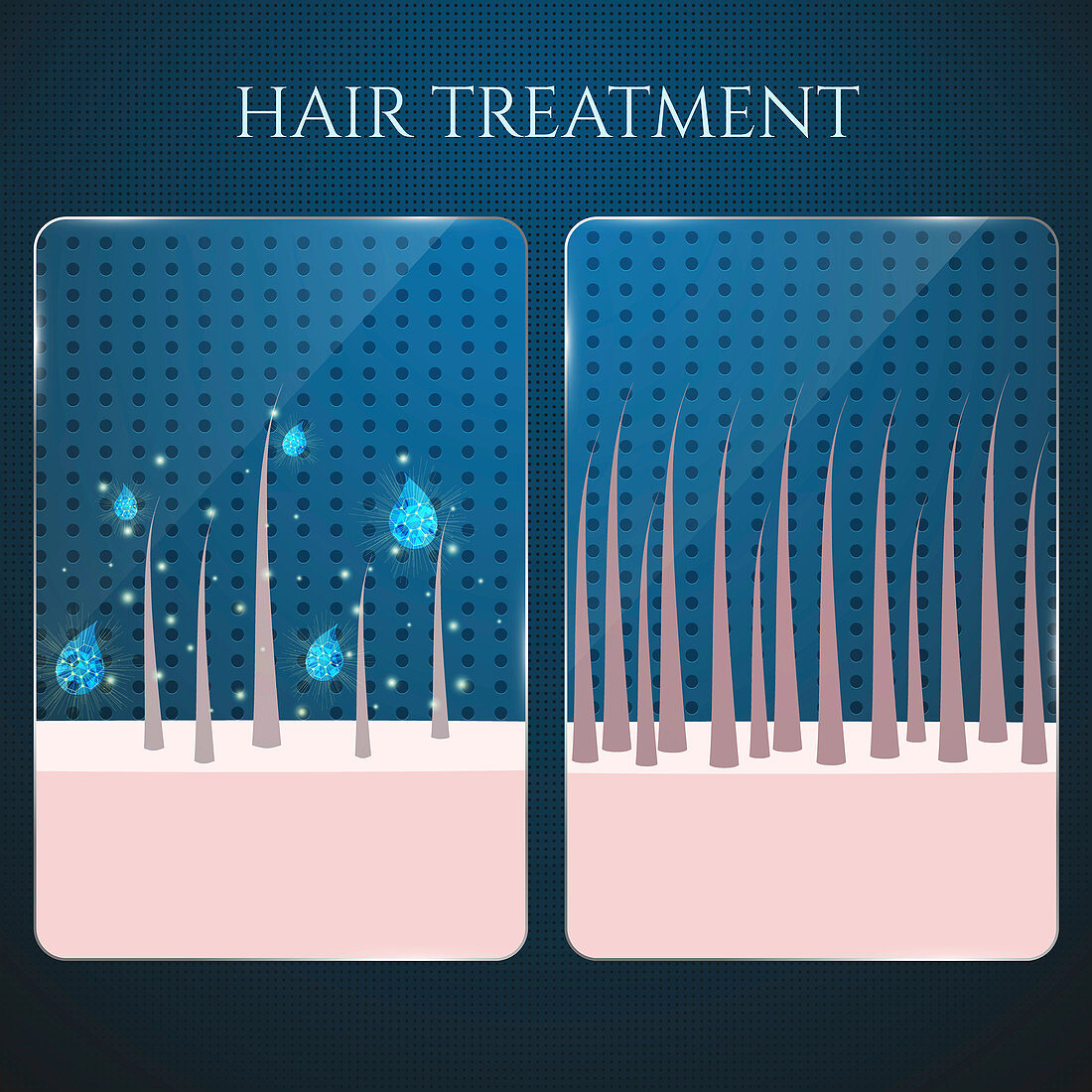 Hair follicle treatment, illustration