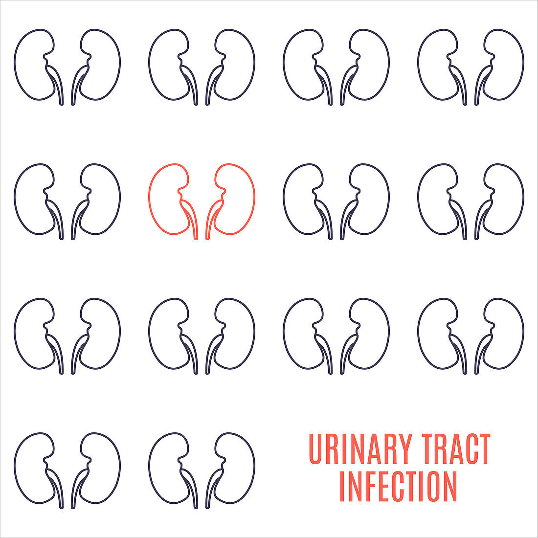 Urinary tract infection, conceptual illustration