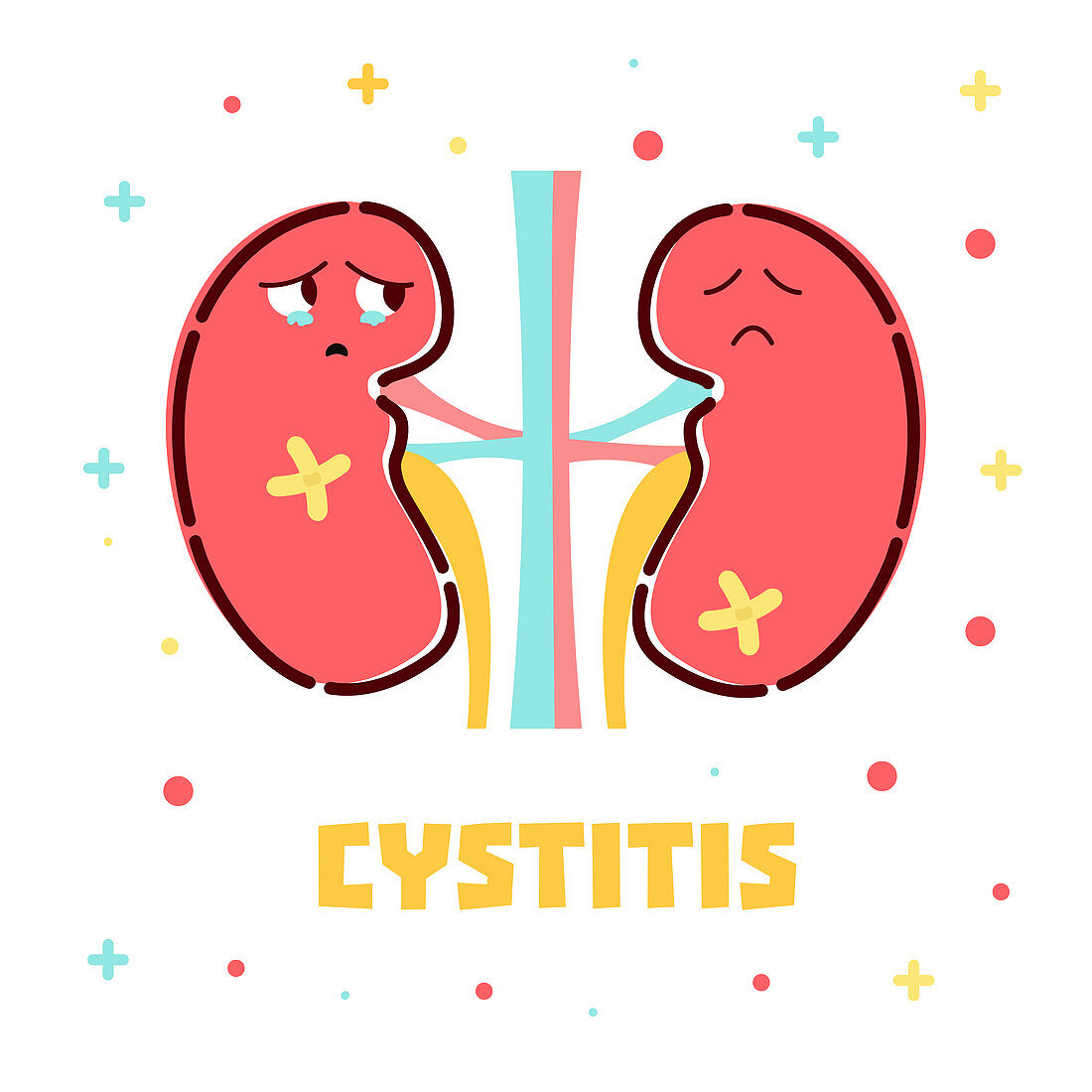 Cystitis, conceptual illustration