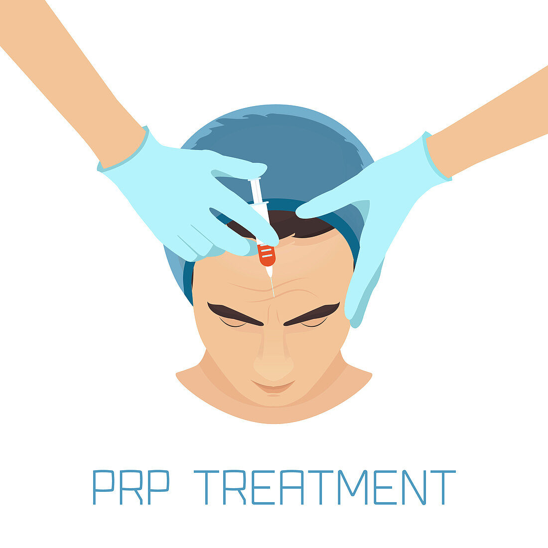 PRP facial treatment for men, illustration