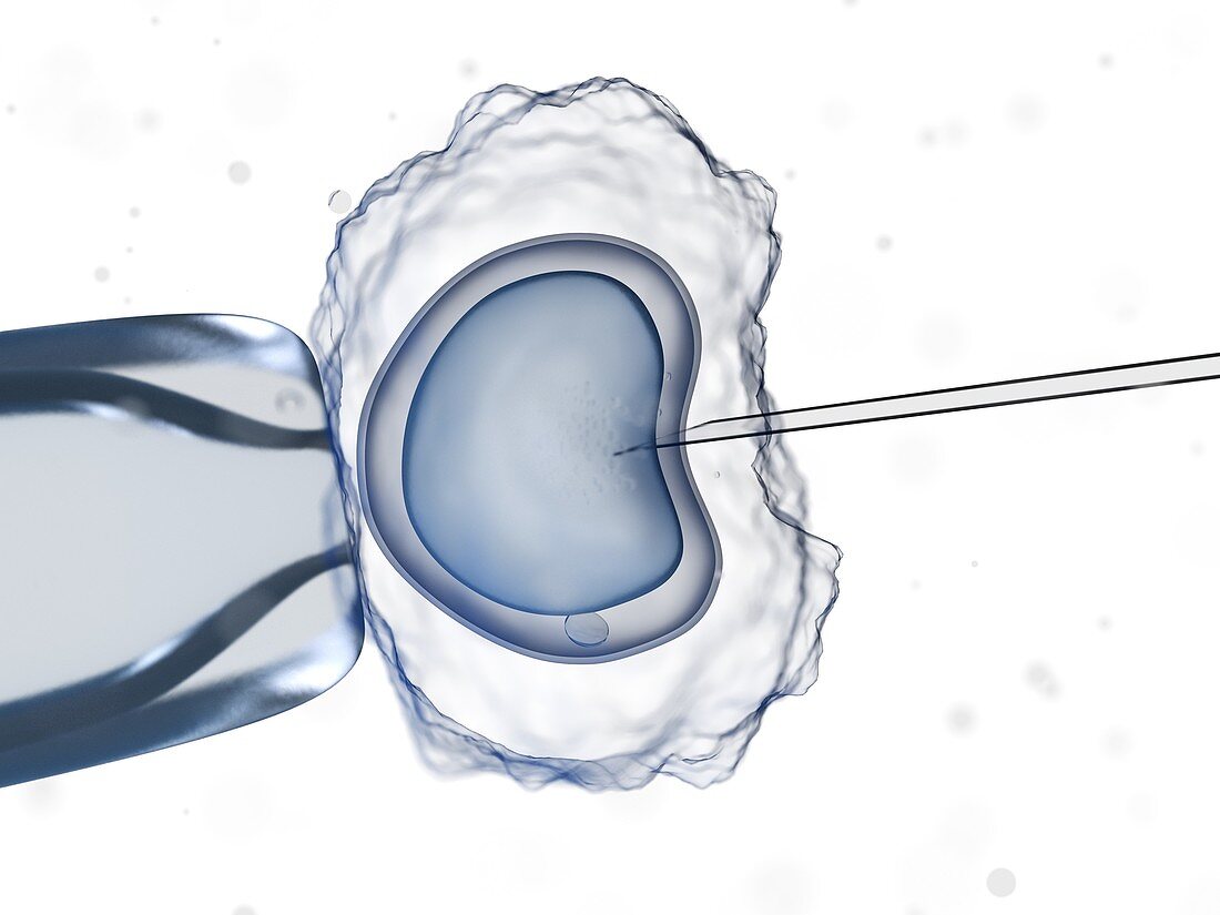 In vitro fertilisation, illustration