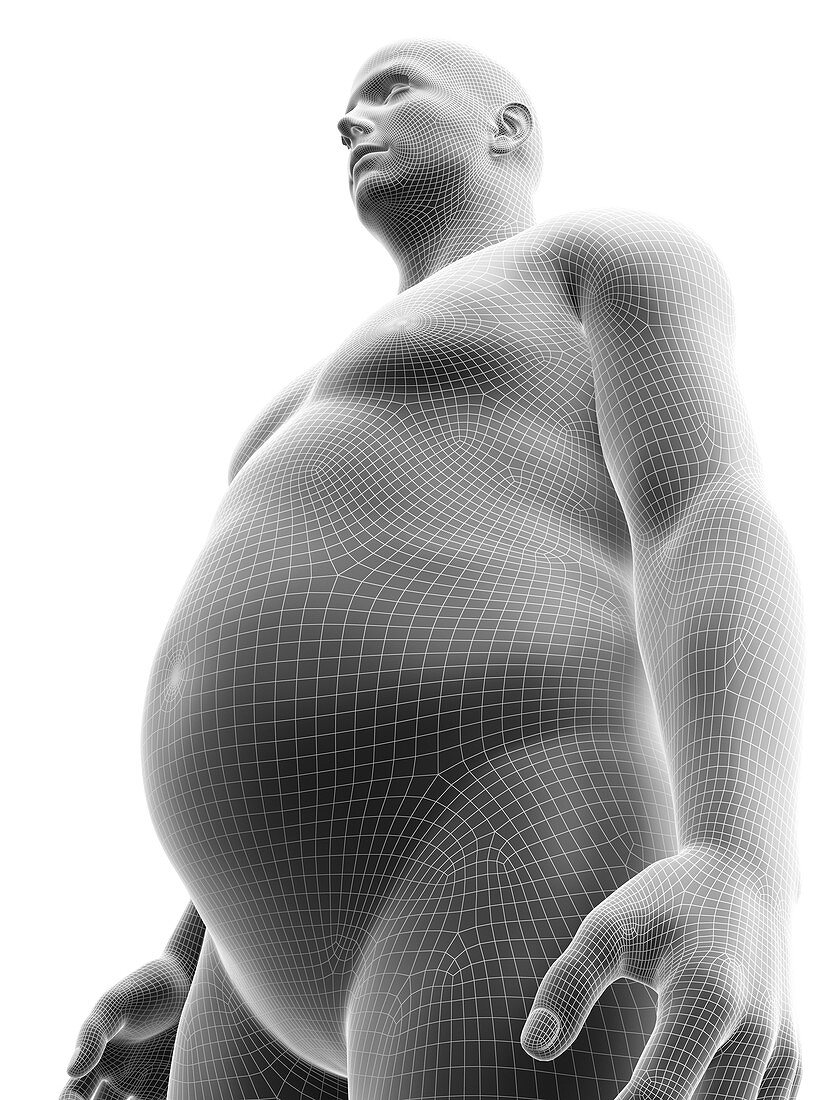 Obese male, illustration